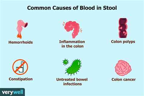 The Unexpected Danger of Blood in Your Stool: What You Need to Know
